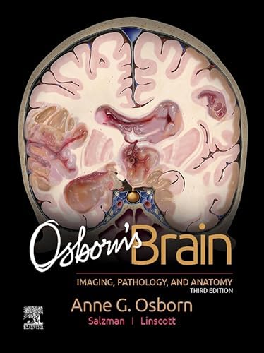 Amazon.com: Rhoton Cranial Anatomy and Surgical Approaches eBook